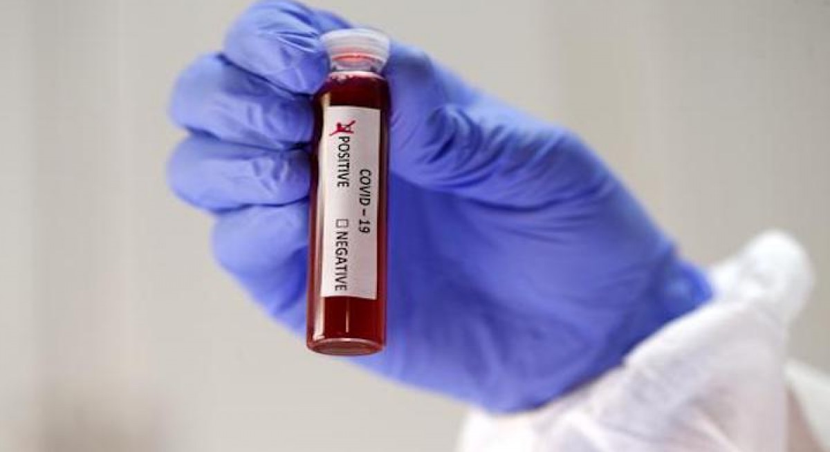 False negatives in Covid-19 testing could hinder containment efforts