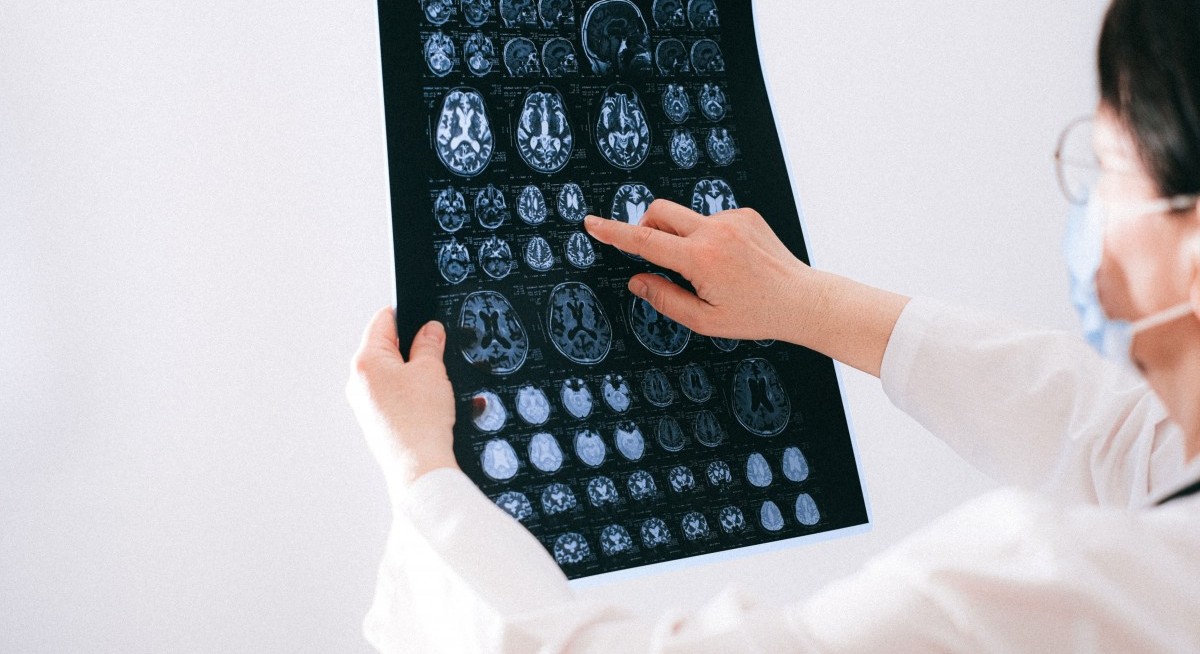 Singapore General Hospital Uses AI to Speed Up Brain Scan Results